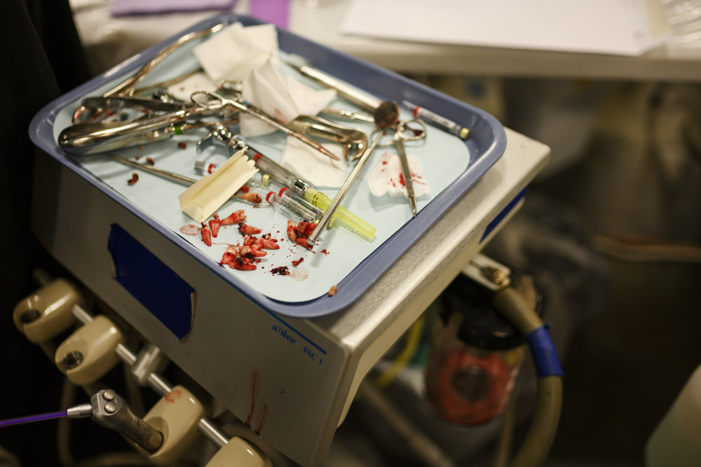 Dental tools and recently removed human teeth sit on a blue tray.